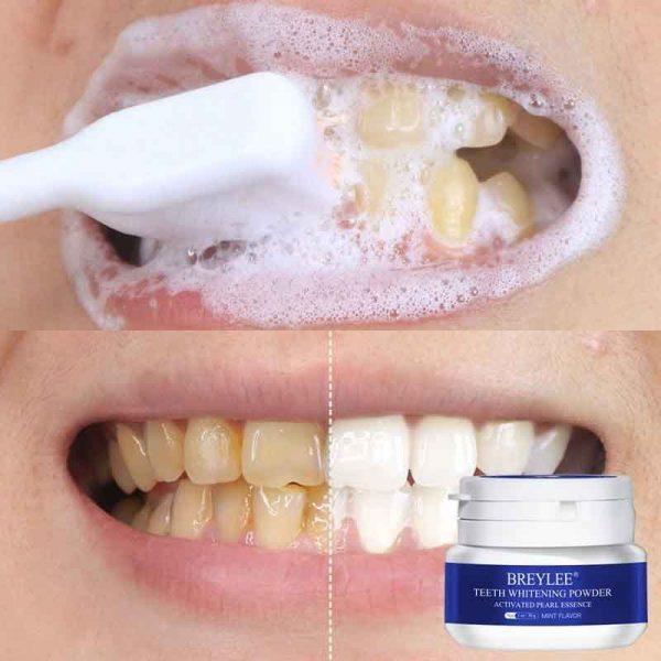 Teeth Whitening Powder White Teeth Cleaning Toothpaste Dental Tools ...